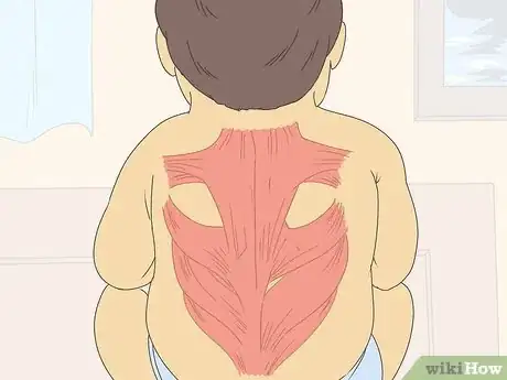 Image titled Diagnose Spinal Muscular Atrophy Step 6