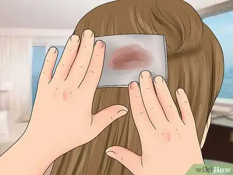 Image titled Evaluate for Head Injuries During First Aid Step 12