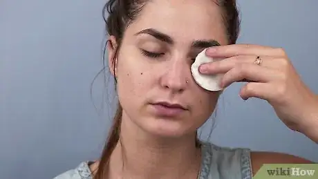 Image titled Get Rid of Blackheads When Your Skin is Sensitive Step 7