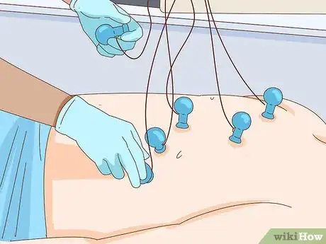 Image titled Identify Atrial Fibrillation Step 14