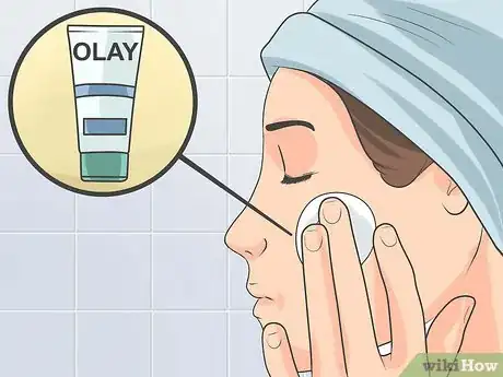 Image titled Treat Cystic Acne Naturally Step 2