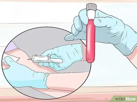Image titled Prepare for a Glucose Screening Test Step 14