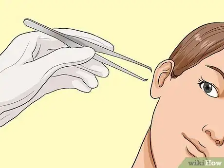 Image titled Get Something out of Your Ear Step 10