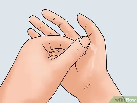 Image titled Get Rid of Peeling Skin Step 4