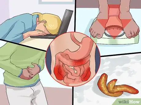 Image titled Explain Crohn's Disease to Others Step 3