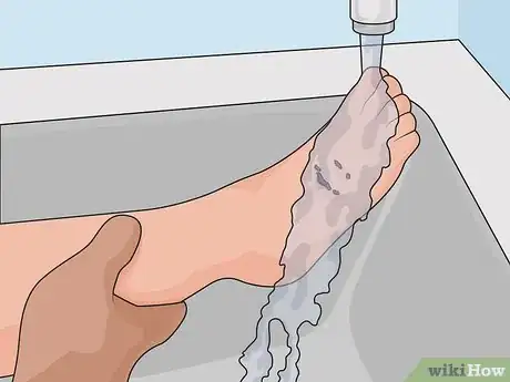 Image titled Treat a Foot Wound Step 02