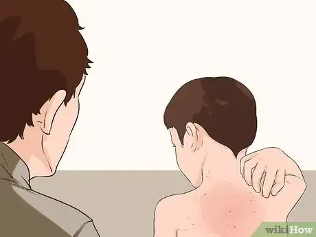 Image titled Identify a Seasonal Allergy Reaction in Young Children Step 5