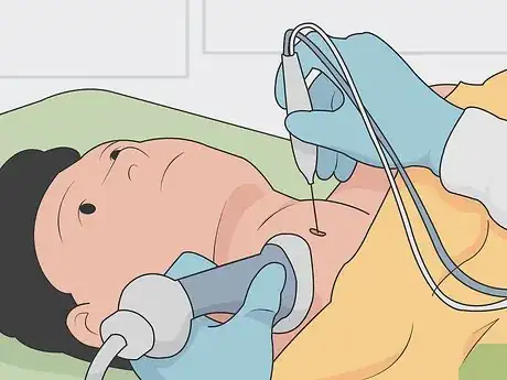 Image titled Treat Thyroid Cancer Step 10