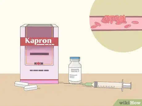 Image titled Treat Menorrhagia Step 3