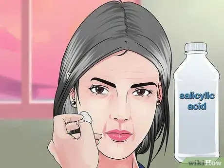 Image titled Reduce Menopausal Acne Step 8