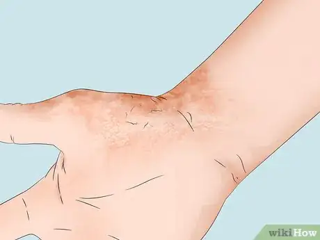 Image titled Stay Safe During a Lightning Storm Step 19