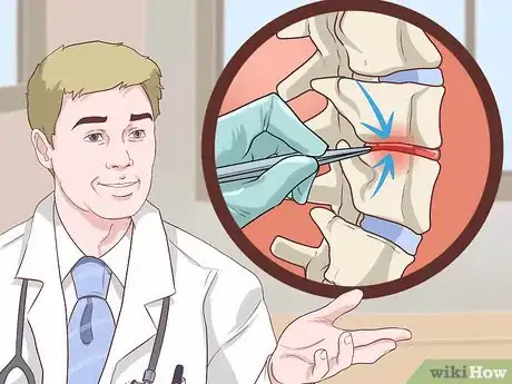 Image titled Diagnose Adult Scoliosis Step 8