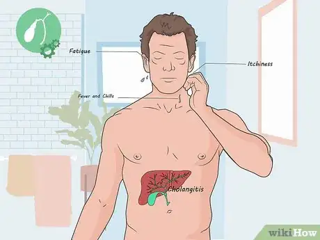 Image titled Treat Cholangitis Step 07