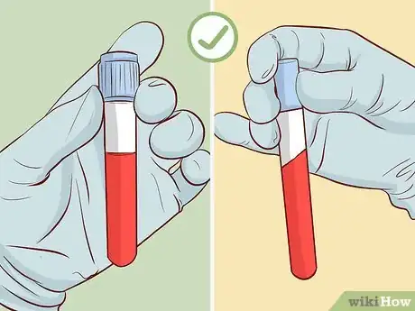 Image titled Find Affordable Options for Egg Donor IVF Step 8