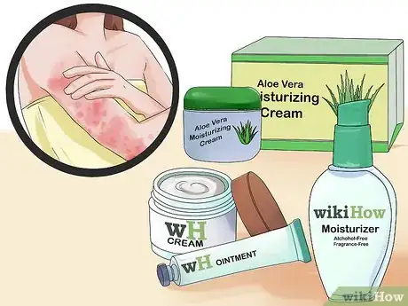 Image titled Choose a Moisturizer for Psoriasis Step 7