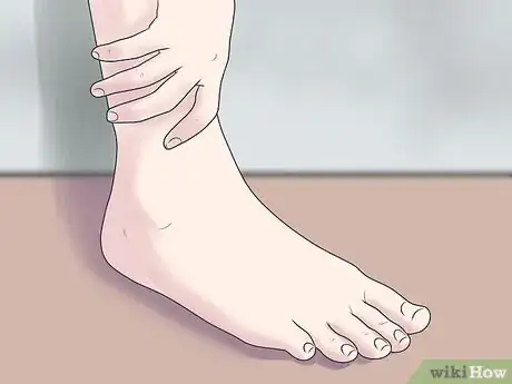 Image titled Treat a Broken Ankle Step 2