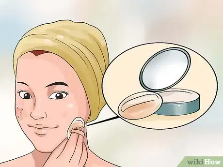 Image titled Hide Pimples Step 11