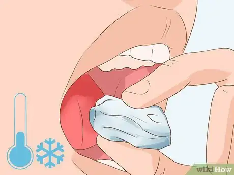 Image titled Heal a Bitten Tongue Step 5