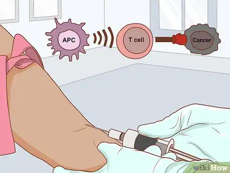 Image titled Treat Pancreatic Cancer Step 11