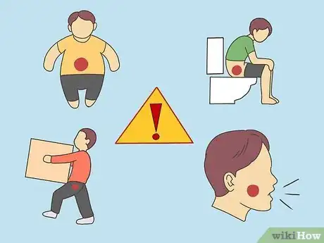 Image titled Treat Inguinal Hernia Step 3