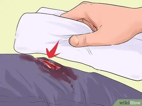 Image titled Treat Severe Bleeding During First Aid Step 10