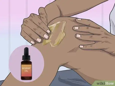 Image titled Use Rosehips for Health Step 10