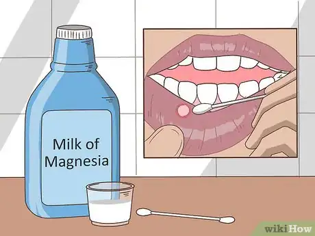Image titled Remove a Mouth Ulcer Step 4