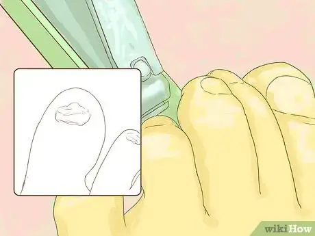 Image titled Look After Your Child's Feet Step 10