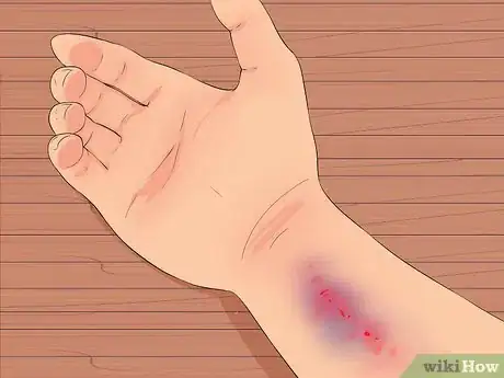 Image titled Evaluate a Nursing Home Step 17