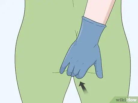 Image titled Treat Pregnancy Hemorrhoids at Home Step 7