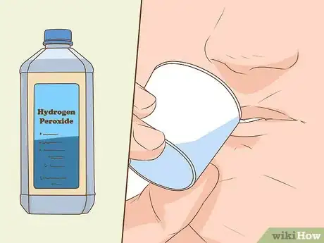 Image titled Heal a Bitten Tongue Step 9