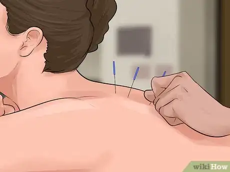 Image titled Choose an Acupuncturist Step 14