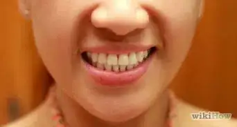 Whiten Your Teeth Without Spending a Lot of Money