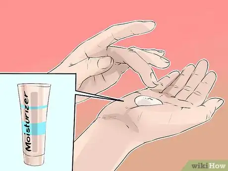 Image titled Treat Eczema in Children Step 4