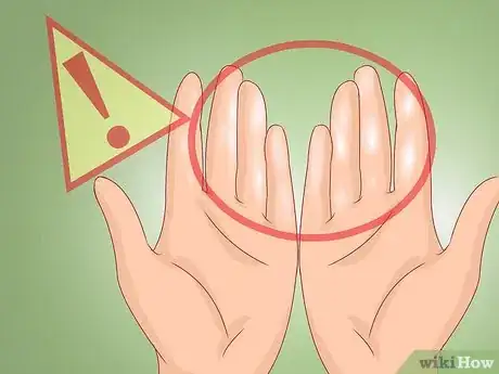 Image titled Recognize Frostbite Step 6