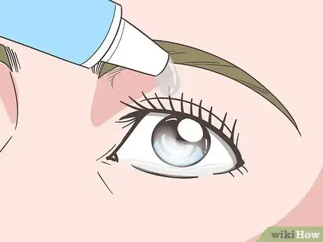 Image titled Manage Eye Disorders with Crohn's Disease Step 3