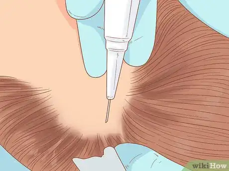 Image titled Stop Hormonal Hair Loss Step 12