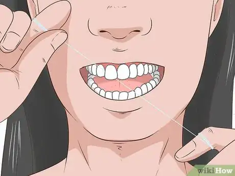 Image titled Treat Gingivitis at Home Step 6