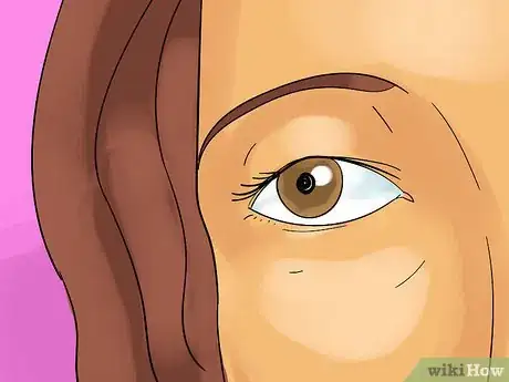 Image titled Deal With Hard Contacts Step 7