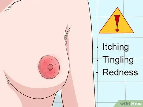 Image titled Treat Breast and Extramammary Paget's Disease Step 10