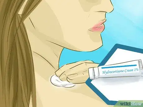 Image titled Stop Scratching a Mosquito Bite Step 12