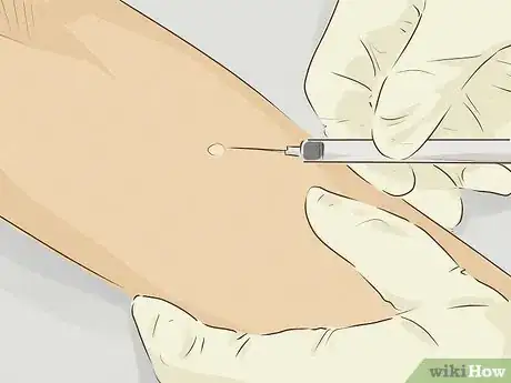 Image titled Get Tested for Allergies Step 4