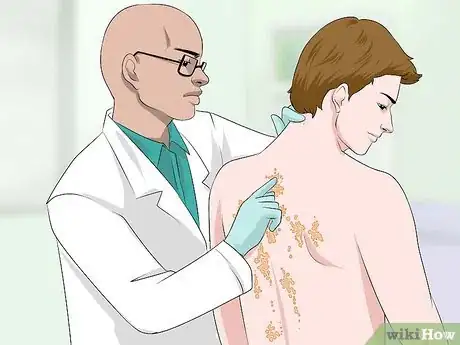 Image titled Reduce Scarring from Eczema Step 5