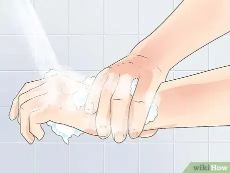 Image titled Prevent Acinetobacter Infection Step 2