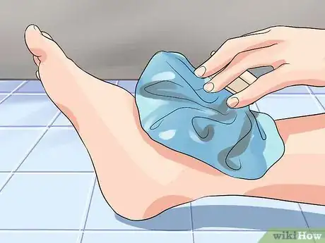 Image titled Avoid Getting Bunions Step 5