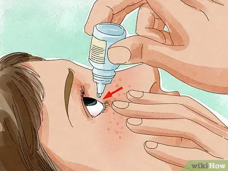 Image titled Protect Your Eyes Step 6