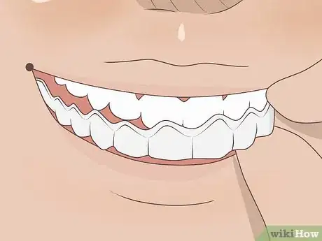 Image titled Prevent a Root Canal Step 4