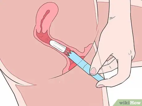 Image titled Insert a Tampon for the First Time Step 9