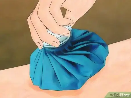 Image titled Prevent Chigger Bites Step 8