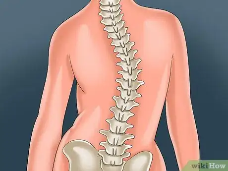 Image titled Deal With Scoliosis Surgery Step 1